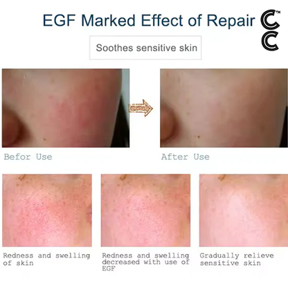 Anti Aging Peptides | EGF Solution - Multiple Repair (3 vials per order)