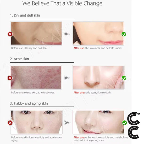 Anti Aging Peptides | VC Serum (10 vials per order) for Face Moisturising Vitamin C Facial Essence